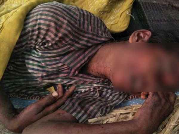 अस्पताल में भर्ती है पीड़िता