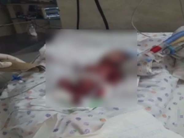 Max Hospital मामले में IPC की धारा 308 के तहत मामला दर्ज, दिल्लीसरकार ने दिए जांच के आदेश Max Hospital मामले में IPC की धारा 308 के तहत मामला दर्ज, दिल्लीसरकार ने दिए जांच के आदेश