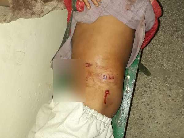 Leopard attacked child in Balrampur, Uttar Pradesh Leopard attacked child in Balrampur, Uttar Pradesh