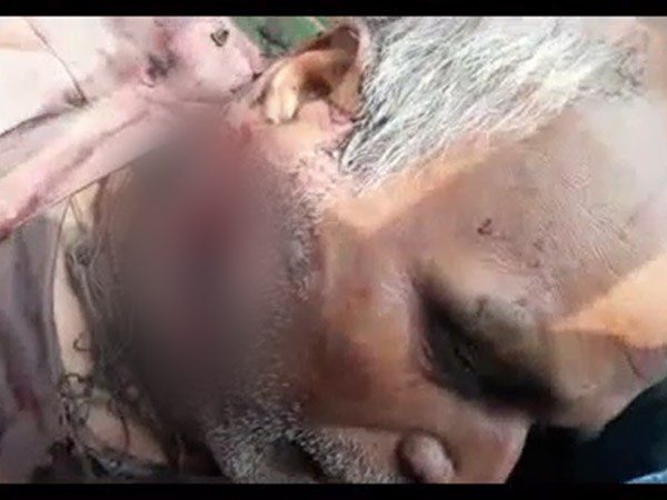 पिता पर धारदार हथियार से किया हमला