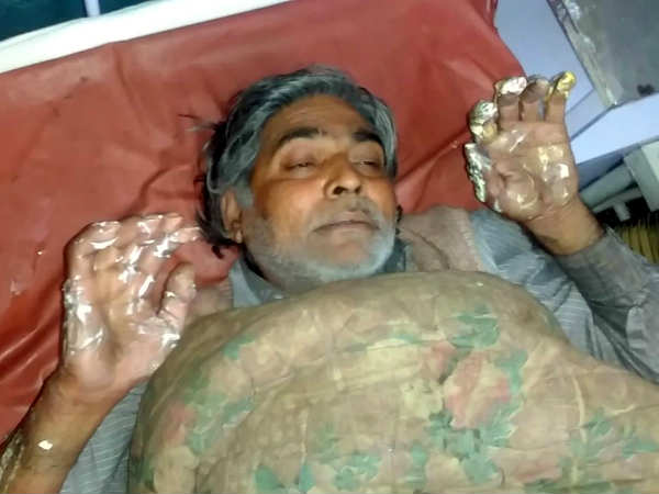 खाना बनाने के लिए जैसे ही जलाई माचिस, आग के गोले में तब्दील हो गया कमरा, 4 झुलसे खाना बनाने के लिए जैसे ही जलाई माचिस, आग के गोले में तब्दील हो गया कमरा, 4 झुलसे