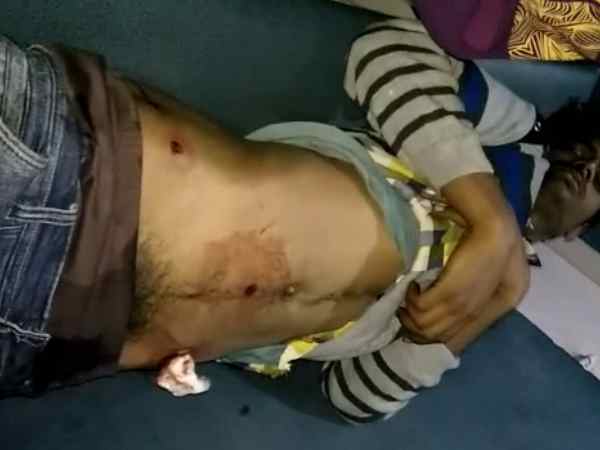 दो युवक गंभीर रूप से घायल