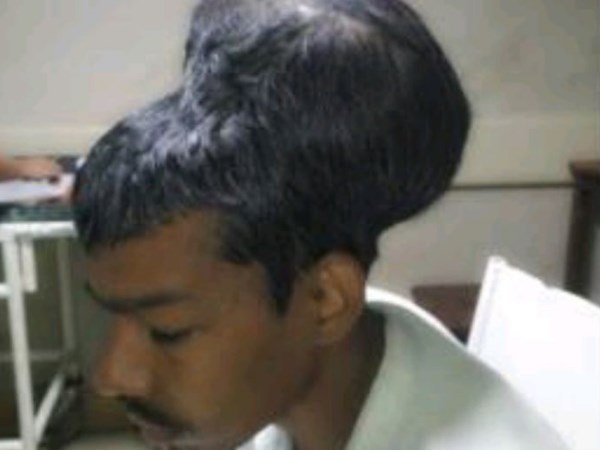 tumor removed from operation in mumbai tumor removed from operation in mumbai