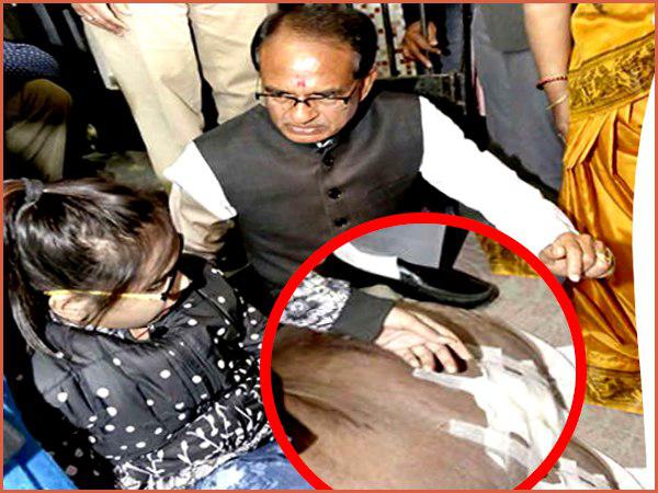 छात्रा की हालत देख भावुक हुए सीएम शिवराज