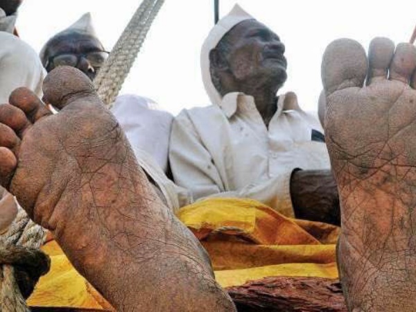 180 किलोमीटर चल पैरों में पड़े छाले