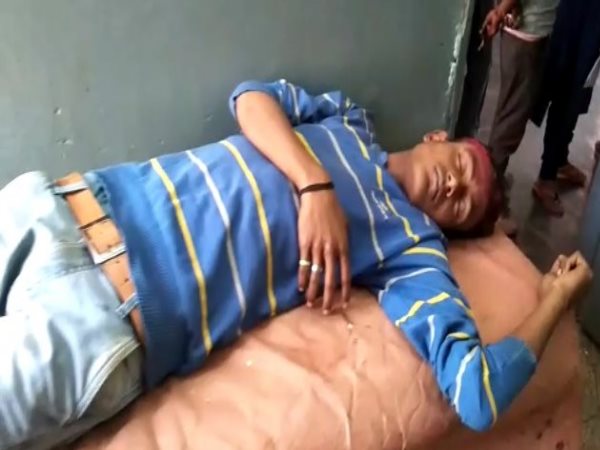 सीएचसी में चल रहा घायल का इलाज