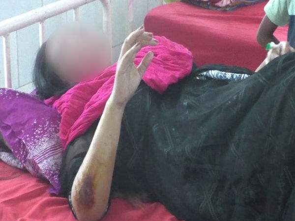 Private school director threw acid in private part of wife Private school director threw acid in private part of wife