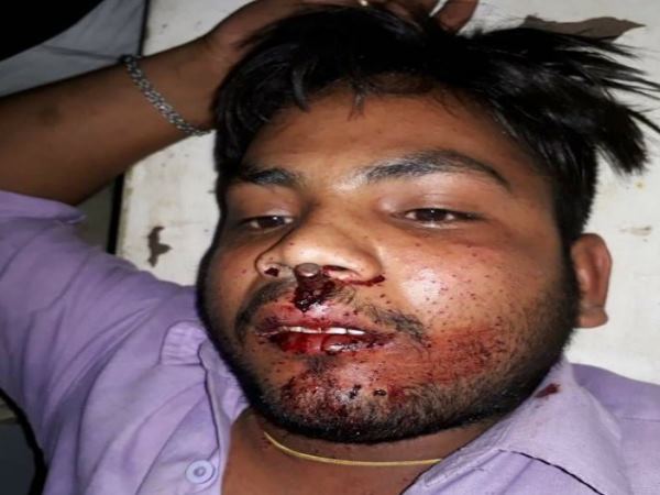 Allahabad man shoots a shopkeeper on asking money for samosa Allahabad man shoots a shopkeeper on asking money for samosa