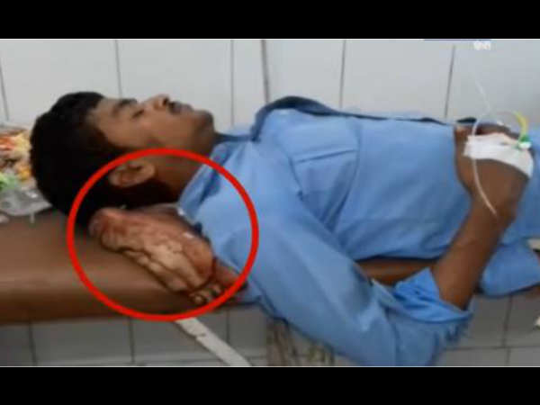 VIDEO: डॉक्टरों की इस घटिया हरकत ने किया इंसानियत को शर्मसार, मरीज का पैर काटकर बना दिया तकिया VIDEO: डॉक्टरों की इस घटिया हरकत ने किया इंसानियत को शर्मसार, मरीज का पैर काटकर बना दिया तकिया
