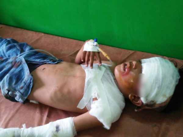 Police car collision, four injured in Mathura Police car collision, four injured in Mathura
