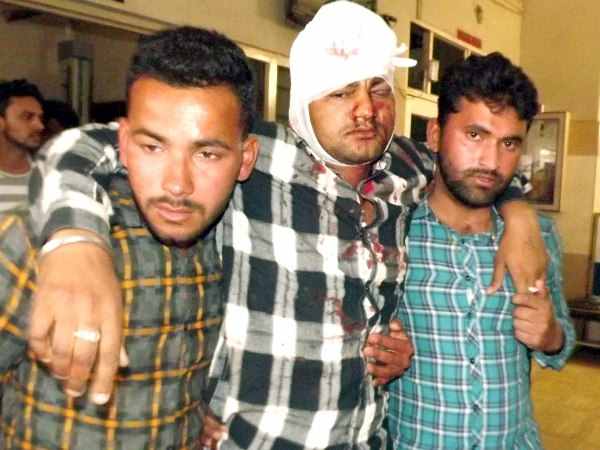 youth shot in Harsh firing in Sultanpur youth shot in Harsh firing in Sultanpur