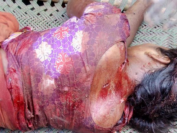 खून से लथपथ अस्पताल में भर्ती