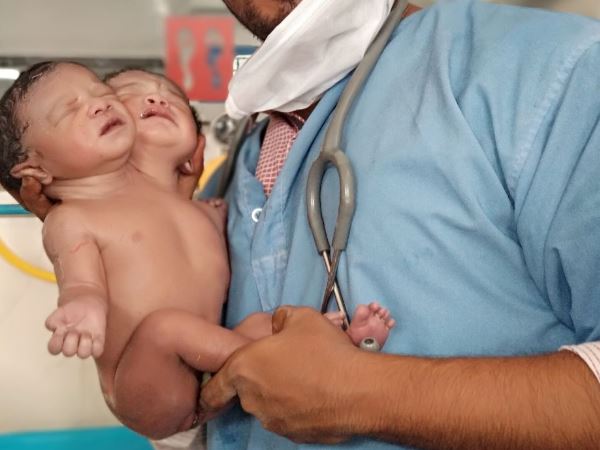 maharashtra unique child born in solapur maharashtra unique child born in solapur