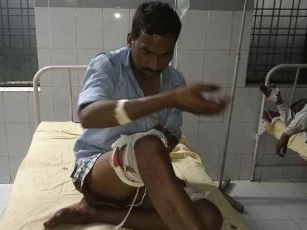 रुपईडीहा में हुई मुठभेड़