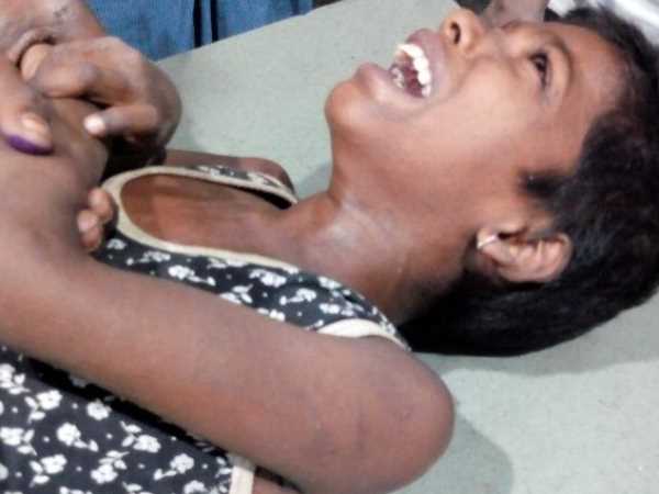 Three children died due to Measles in Bahraich Three children died due to Measles in Bahraich