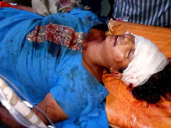 Husband attacked his wife with hammer in Shahjahanpur Husband attacked his wife with hammer in Shahjahanpur
