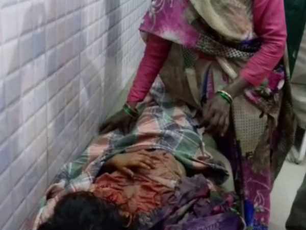 Dog attacked three children and injured them in Moradabad Dog attacked three children and injured them in Moradabad