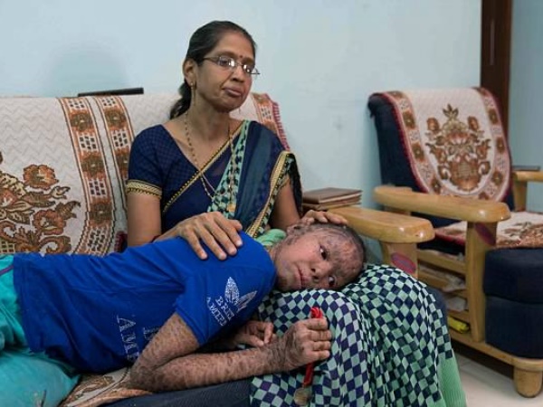 मां-बाप को है इलाज की उम्मीद