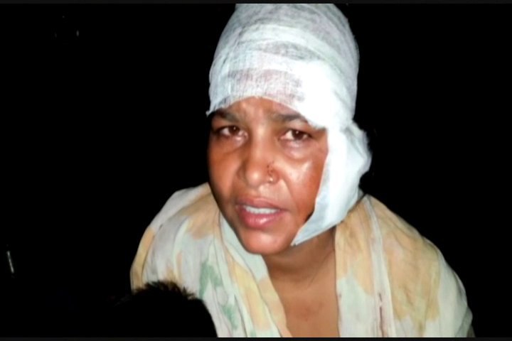 Daughther in law beaten by relatives and police not taking action in Hardoi Daughther in law beaten by relatives and police not taking action in Hardoi