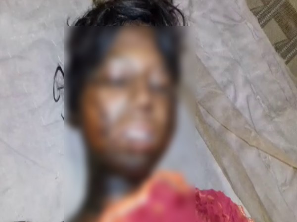 इज्जत बचाने को जमकर किया विरोध, रेपिस्ट ने जलाया