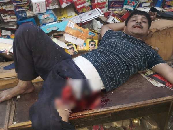 allahabad man came to kill a shopkeeper injured badly as bomb blast in its pant pocket allahabad man came to kill a shopkeeper injured badly as bomb blast in its pant pocket