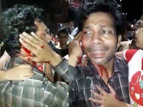 up police beaten a man in front of his daughter and wife up police beaten a man in front of his daughter and wife