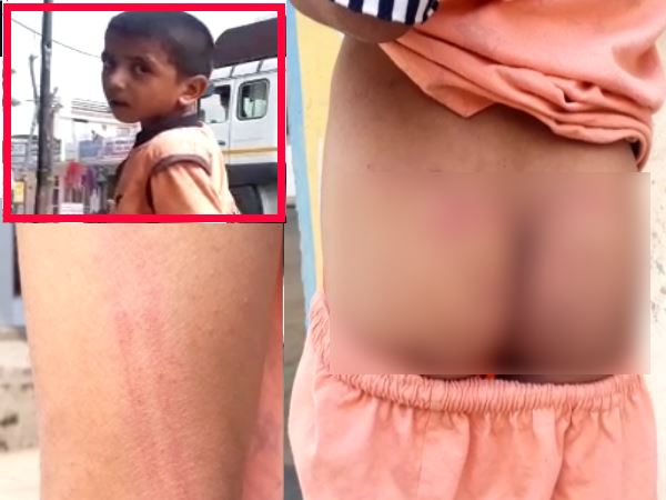 shamli teacher beaten a boy very badly boy fainted shamli teacher beaten a boy very badly boy fainted