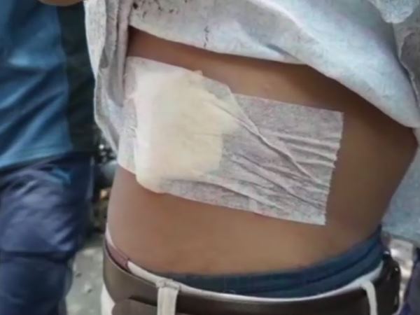 Clashes erupted Banaras Hindu University BHU student stabbed Clashes erupted Banaras Hindu University BHU student stabbed