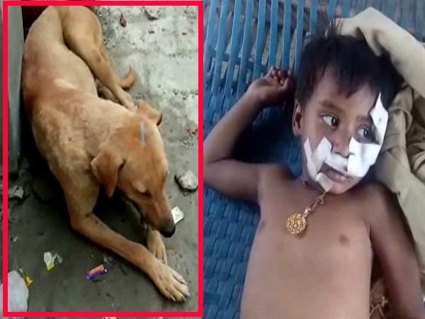 hardoi dog bite a 4 years old girl very badly hardoi dog bite a 4 years old girl very badly
