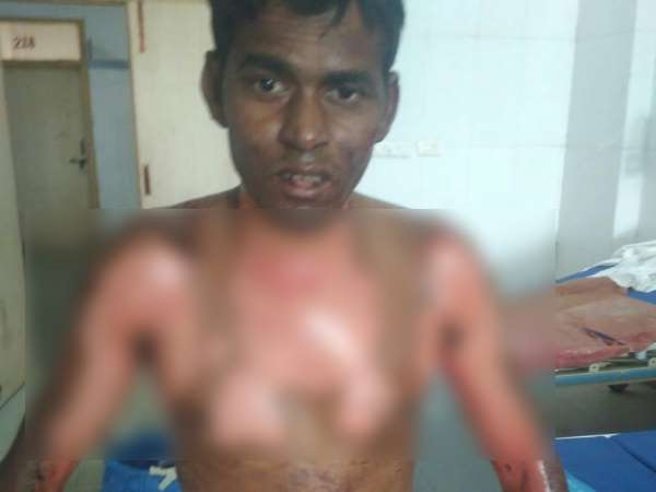 Wife killed in fire and husband injured in Kannauj Wife killed in fire and husband injured in Kannauj