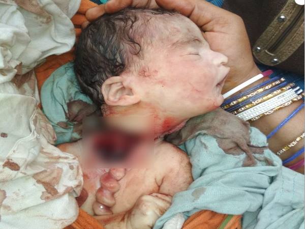 A new born baby died due to carelessness of doctor in Sultanpur A new born baby died due to carelessness of doctor in Sultanpur