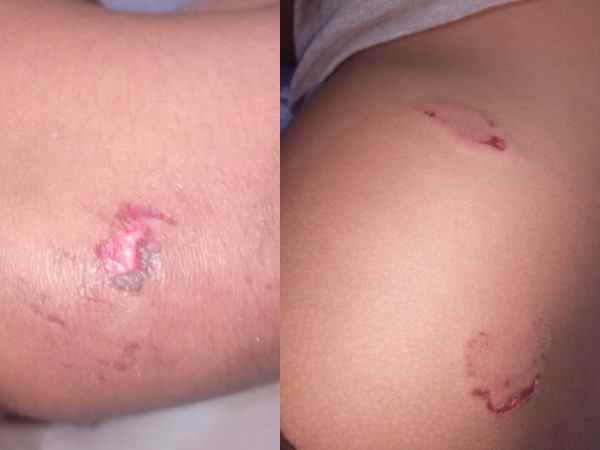 Monkey group attacked on child in Varanasi Monkey group attacked on child in Varanasi