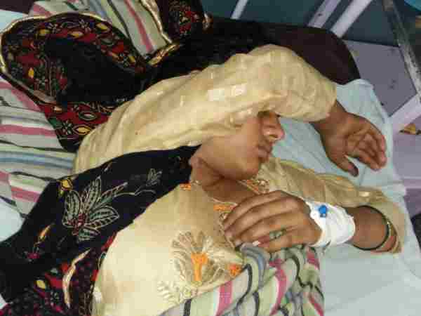 Acid thrown by husband on his wife in Saharanpur Acid thrown by husband on his wife in Saharanpur