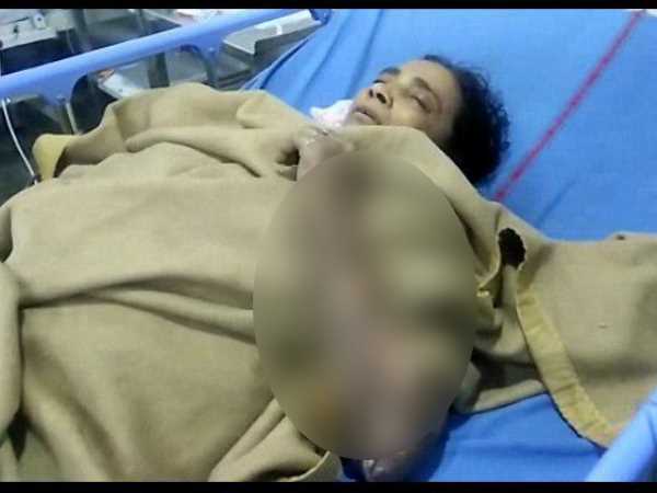 तेजाब और पेट्रोल डालकर जलाया