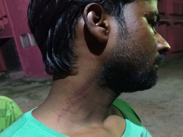 एक की हालत नाजुक