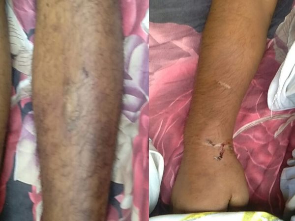 पुलिसकर्मियों के खिलाफ मामला दर्ज