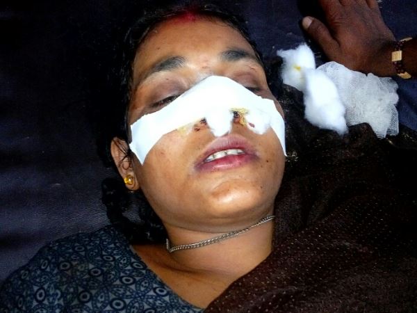husband cut a knife with the wife nose husband cut a knife with the wife nose
