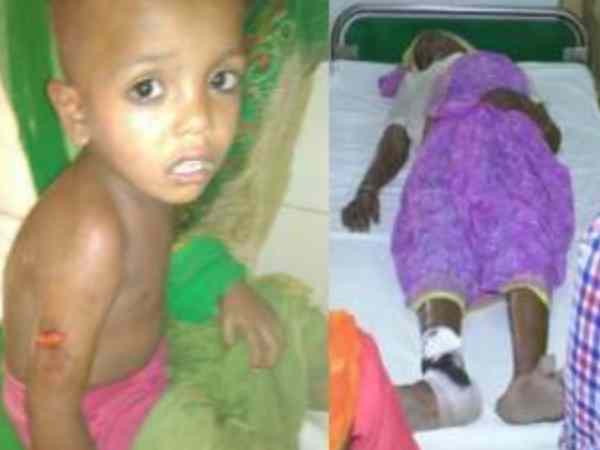 Dogs attacked again on a child and woman in Sitapur Dogs attacked again on a child and woman in Sitapur