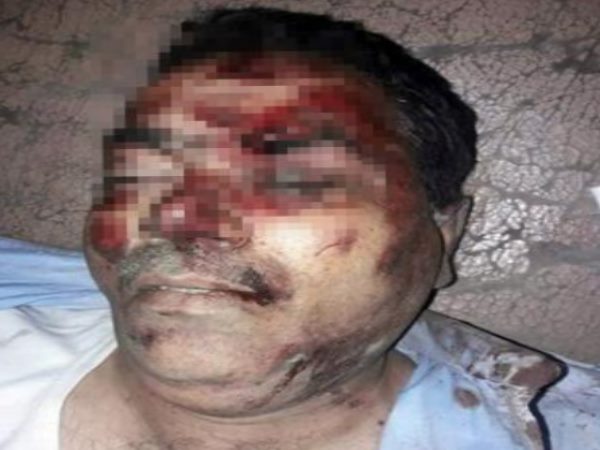 himachal pradesh doon former mlas brother killed by chopping his throat himachal pradesh doon former mlas brother killed by chopping his throat