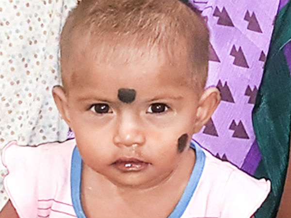 सर्जरी के लिए पैसे नहीं