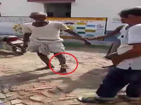 A snake trapped in leg of man form Bihar A snake trapped in leg of man form Bihar
