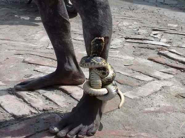 A snake trapped in leg of man form Bihar A snake trapped in leg of man form Bihar