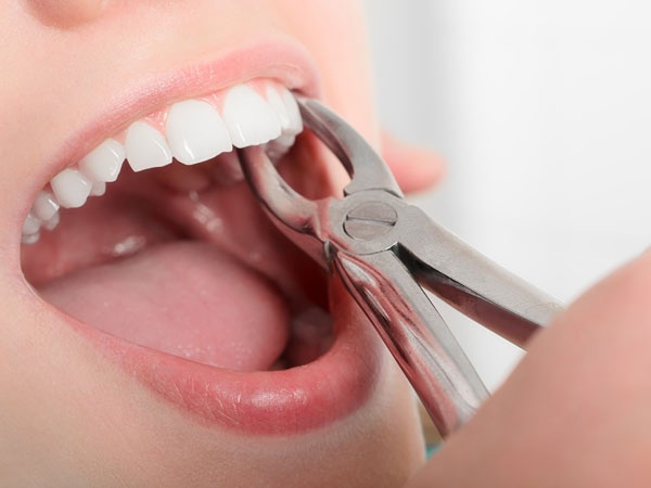 women dies after teeth removal in patna women dies after teeth removal in patna