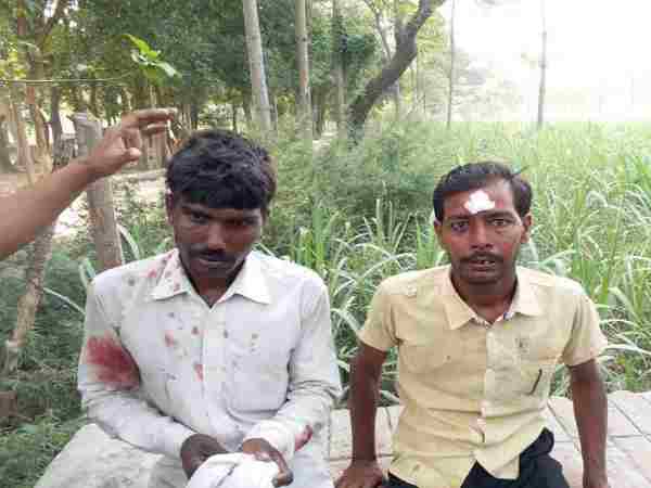 Six injured when lepard attacked in Sitapur Six injured when lepard attacked in Sitapur