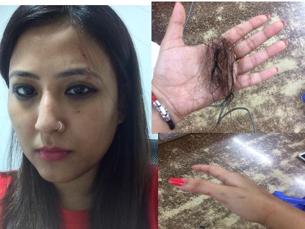 महिला ने उनके चेहर पर नाखून से हमला कर दिया और उनके बाल भी नोचे