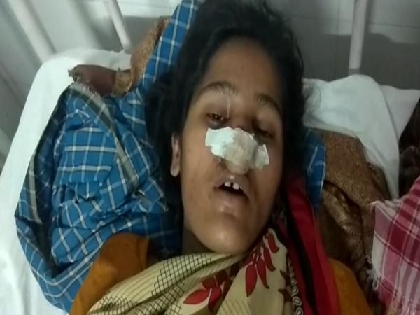 SHAHJAHANPUR husband cuts his wifes nose SHAHJAHANPUR husband cuts his wifes nose