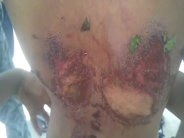 10 year old kid beaten by his step mother and father, video 10 year old kid beaten by his step mother and father, video