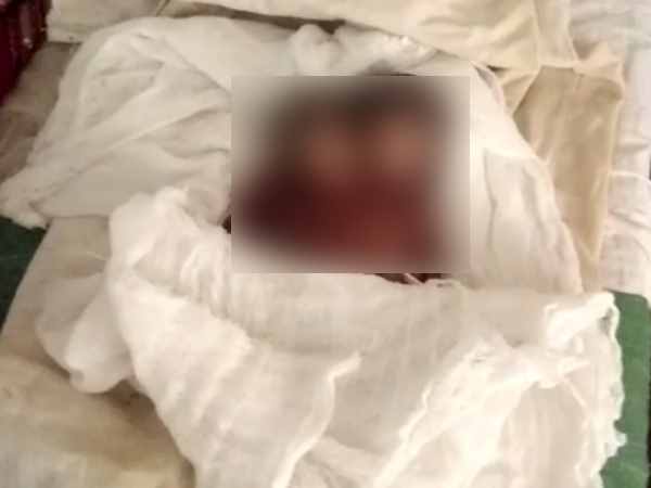 Woman gave birth to two-headed newborn baby Woman gave birth to two-headed newborn baby