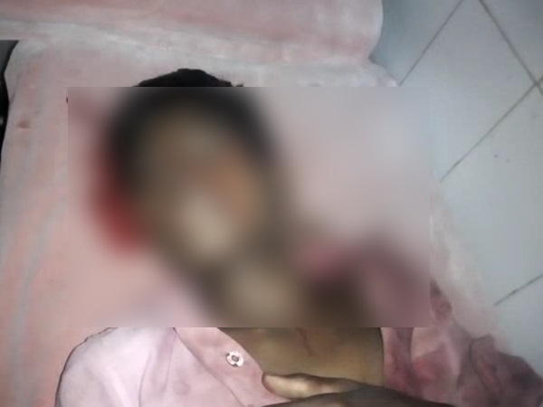 three people were injured in firing in Shahjahanpur three people were injured in firing in Shahjahanpur