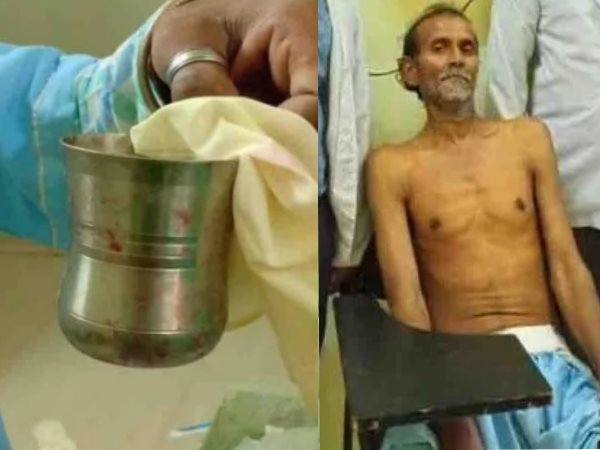 रेअर ऑफ द रेयरेस्ट केस